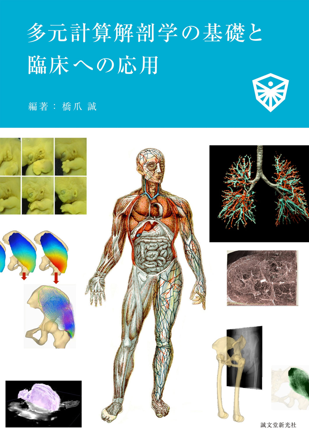 Basics of multidimensional computational anatomy and its clinical application